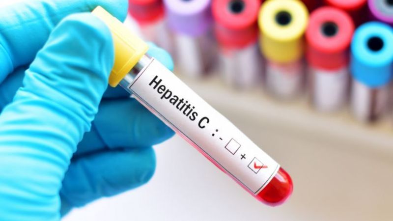 hepatit-c-1627368473.jpg