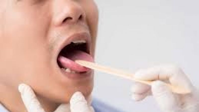 Ağızda Ve Dilde Uyuşma Neden Olur? Dil Uyuşması İçin Hangi Doktora Gidilmeli? Dil Uyuşması Nasıl Geçer? 3