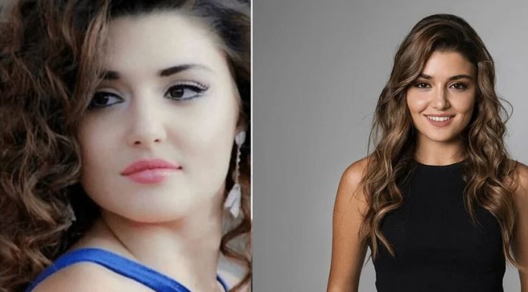 Hande Erçel Estetik Güzeli Çıkınca Ortalık Karıştı! Sosyal Medya Tepki Üzerine Tepki Gösterdi! “Benimde Param Olsa Bende Böyle Güzel Olurum” 4