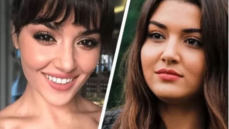 Hande Erçel Estetik Güzeli Çıkınca Ortalık Karıştı! Sosyal Medya Tepki Üzerine Tepki Gösterdi! “Benimde Param Olsa Bende Böyle Güzel Olurum” 3