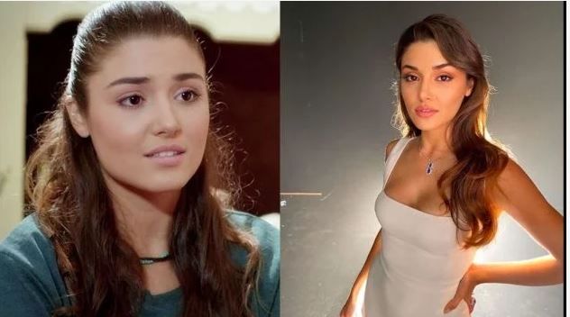 Hande Erçel Estetik Güzeli Çıkınca Ortalık Karıştı! Sosyal Medya Tepki Üzerine Tepki Gösterdi! “Benimde Param Olsa Bende Böyle Güzel Olurum” 1
