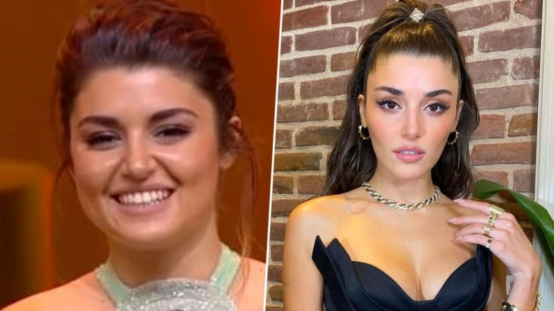 Hande Erçel’in Yıllar Önceki Hali Dudak Uçuklattı! Yapılan Estetikler İfşa Oldu! Burnu, Dudaklar, Yüzü O Biçim… “Doktorun Kimdi?” 4