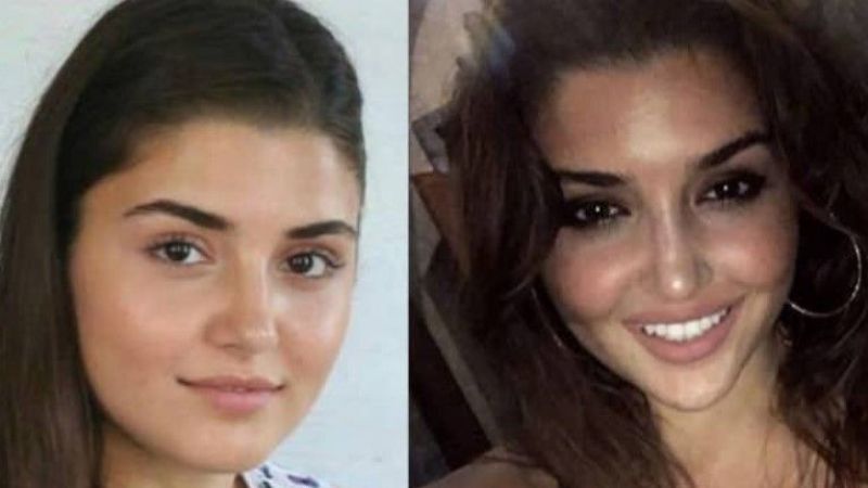 Hande Erçel’in Yıllar Önceki Hali Dudak Uçuklattı! Yapılan Estetikler İfşa Oldu! Burnu, Dudaklar, Yüzü O Biçim… “Doktorun Kimdi?” 5