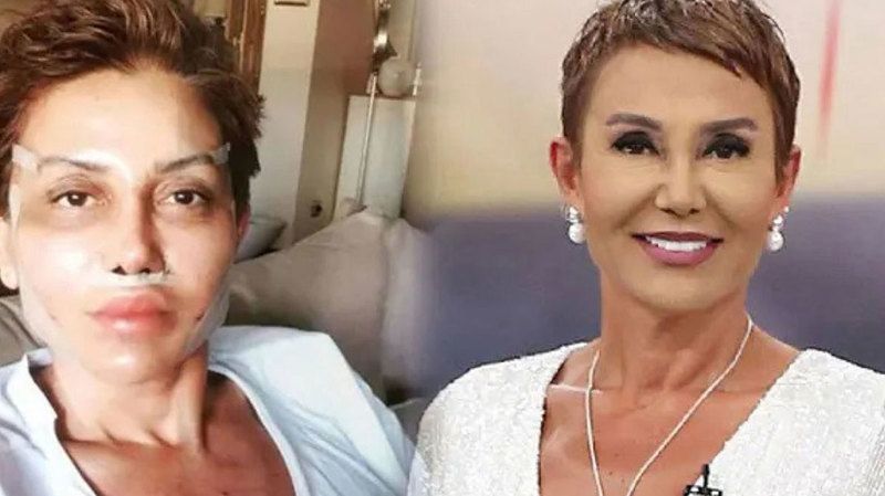 Serap Paköz’ün Son Halini Görenler Tanıyamıyor! “Bacım Ne Oldu Sana!” 57’lik Bir Fırtınaya Dönüştü, Sosyal Medya Ayağa Kalktı! 2