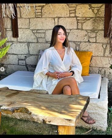 Masterchef Pelin’i Estetik Harikası Oldu Çıktı! Güzelliğiyle “Danilo Şefin Kalbini Çalmıştı” Ama Son Hali Artık Tanınamaz Halde! Ağzı, Yüzü, Gözü, Kaşı… 4