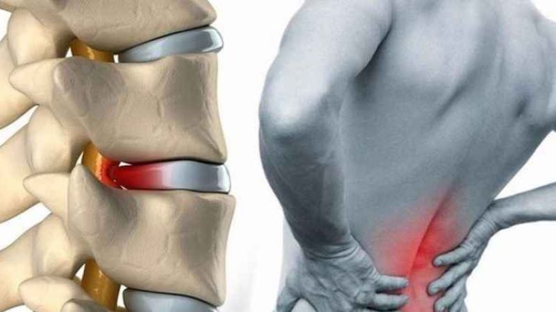 Bel Fıtığı İçin Hangi Bölüme ve Doktora Gidilir? Bel Fıtığına Bakan Poliklinikten Nasıl Randevu Alınır? 1
