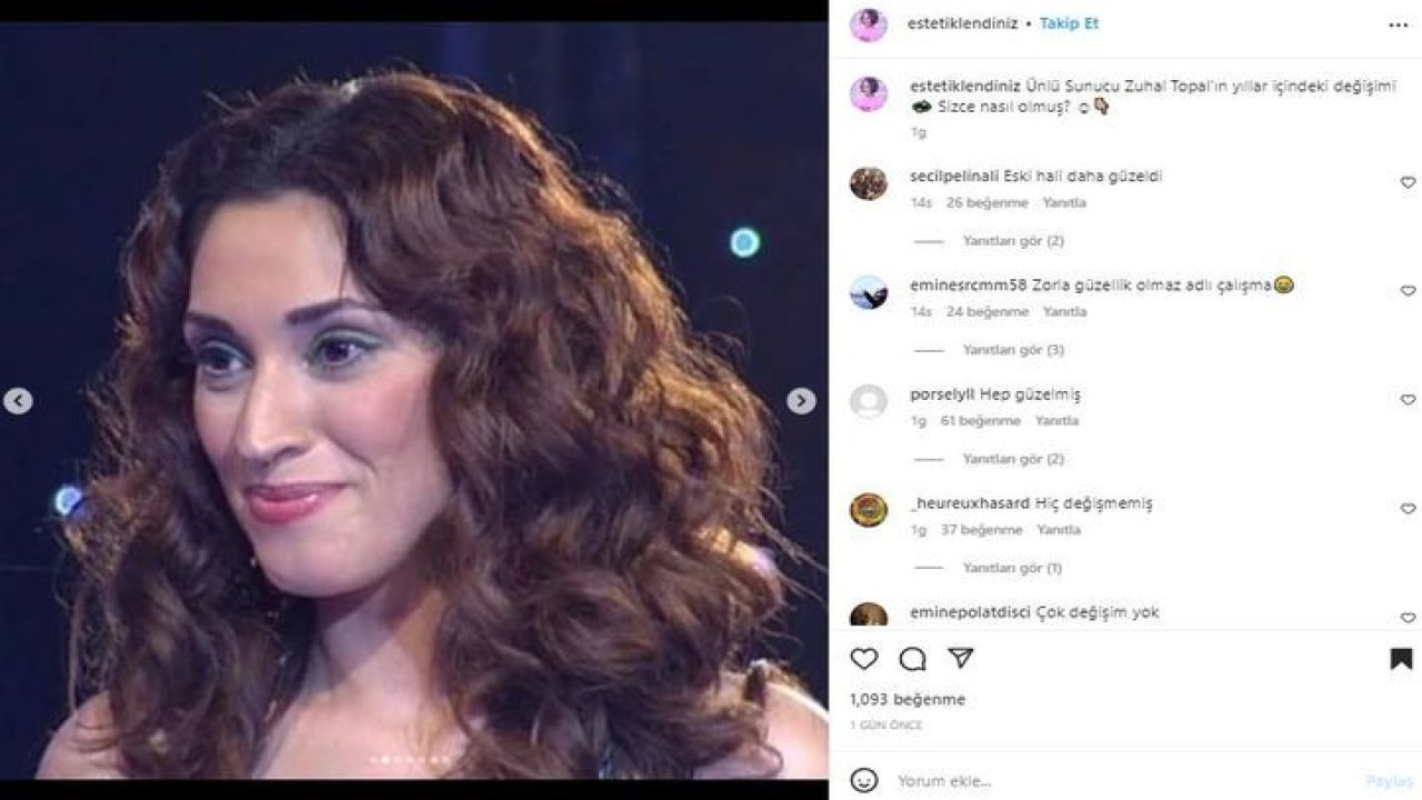 Zuhal Topal’ın Estetiksiz Halleri “Düşman Başına” Dedirtti! Burnu, Ağzı, Yüzü… Kimse Tanıyamıyor; Doktor Harikası Çıktı! Görenler Şok Oluyor…