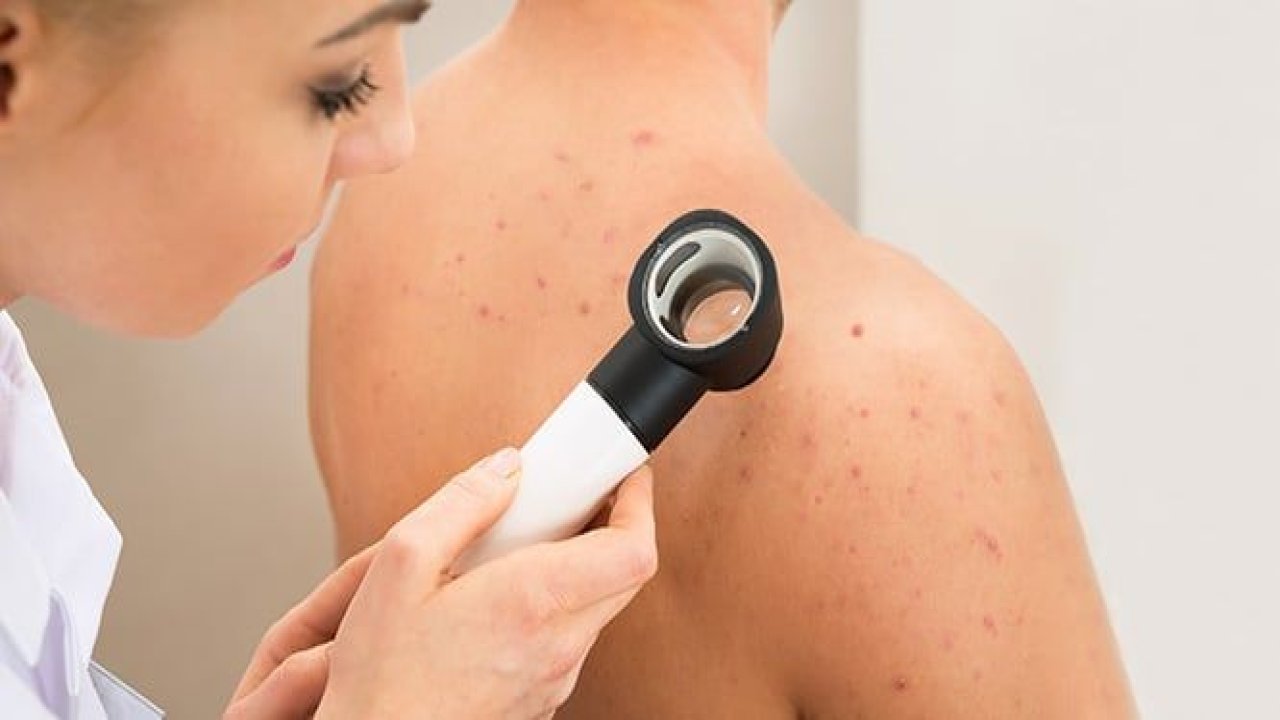 Ankara’da Hangi Hastanede Cildiye Var? Ankara Şehir Hastanesi Dermatoloji Bölümü Nerede? Ankara'da En İyi Cildiye Doktoru Kimdir?