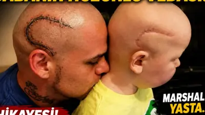 Ameliyat İzini Dövme Yaptıran Babanın Hüzünlü Vedası! Marshall Yasta... Hikayesi!