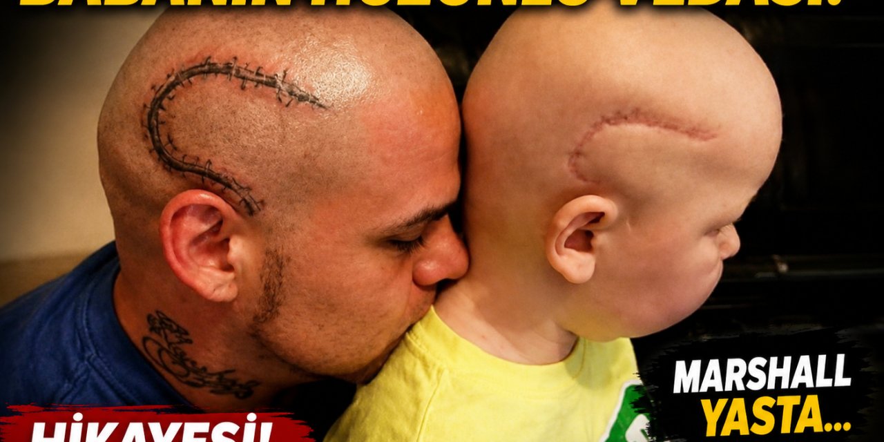 Ameliyat İzini Dövme Yaptıran Babanın Hüzünlü Vedası! Marshall Yasta... Hikayesi!